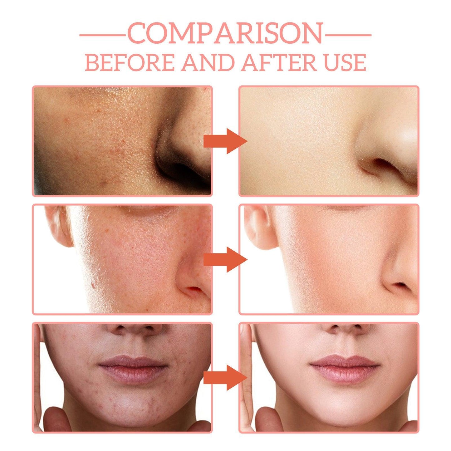 5-in-1 Hydrating Serum - NEXTREND